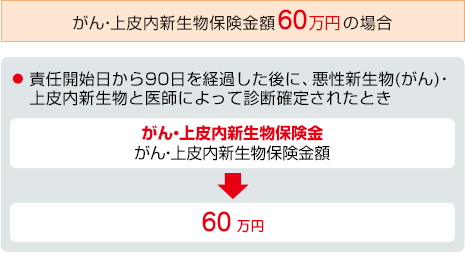 お支払事由図 がん・上皮内新生物保険金額 60万円の場合